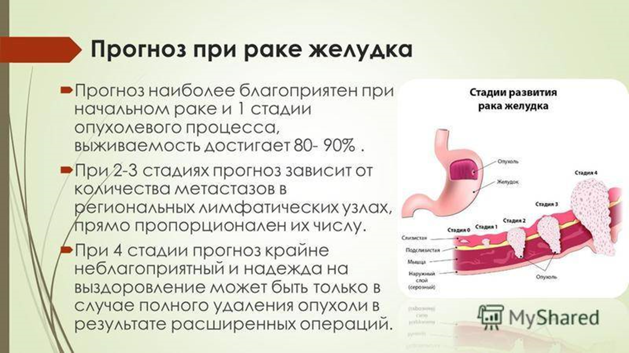 Какие симптомы у рака желудка Infomed Дзен